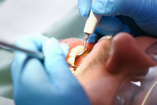 Best Emergency Gum Treatment in West Chicago, IL
